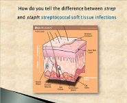 Overview of Cellulitis PowerPoint Presentation Notes