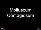 Molluscum contagiosum