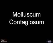 Molluscum contagiosum PowerPoint Presentation