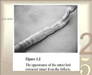 Hair Loss and Treatment PowerPoint Presentation