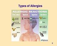 Allergies Allergens and Food Handlers PowerPoint Presentation