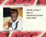 Nutrition and Diet Therapy PowerPoint Presentation Notes