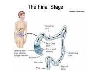 Digestion and Absorption PowerPoint Presentation Notes