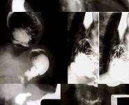 GI Imaging PowerPoint Presentation