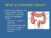 Overview of Colorectal Cancer