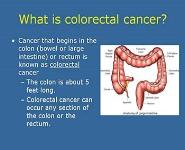 Overview of Colorectal Cancer PowerPoint Presentation