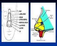 Nasal Disease PowerPoint Presentation Notes
