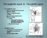 Malignant Lesions of the Larynx PowerPoint Presentation Notes
