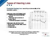 The Basics of Hearing Health Care