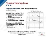 The Basics of Hearing Health Care PowerPoint Presentation Notes