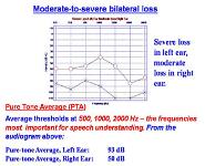 Hearing Disorders PowerPoint Presentation Notes