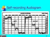 The Audiogram