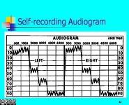 The Audiogram PowerPoint Presentation Notes