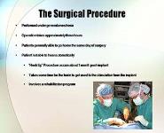 Cochlear Implant Presentation PowerPoint Presentation Notes