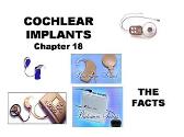 Cochlear Implants
