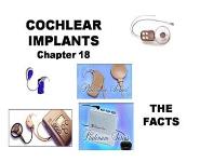 Cochlear Implants PowerPoint Presentation Notes