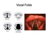 Vocal Mechanism PowerPoint Presentation Notes