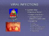 Immune Response to Infectious Disease