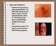 Viral Diseases PowerPoint Presentation