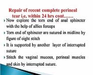 Birth Canal Injuries PowerPoint Presentation