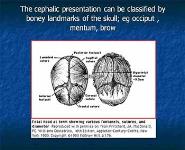 Mechanisms and Management of Labor PowerPoint Presentation