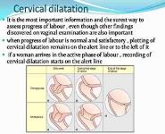 Partograph PowerPoint Presentation