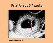 Issues in Early Pregnancy PowerPoint Presentation