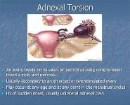 Gynecologic Emergencies PowerPoint Presentation