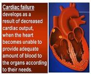 Drugs used in the Treatment of Cardiac Failure PowerPoint Presentation