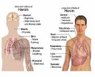 OPIOID ANALGESICS PowerPoint Presentation