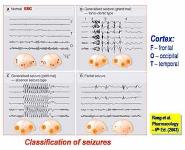 Antiseizure-antiepileptic drugs PowerPoint Presentation