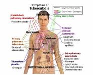 Beta-Lactam Antibiotics PowerPoint Presentation Notes