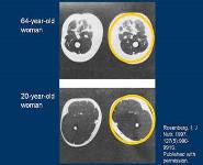 POLYPHARMACY PowerPoint Presentation