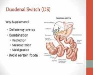 Nutrition and Weight Loss Surgery PowerPoint Presentation