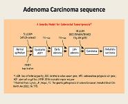 Benign And Malignant Tumors of The Rectum PowerPoint Presentation