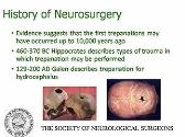 Introduction to Neurosurgery