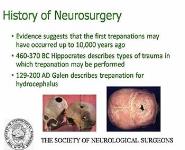 Introduction to Neurosurgery PowerPoint Presentation