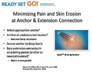 Spinal Cord Stimulators and Failed Back Syndrome PowerPoint Presentation