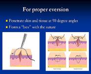 Facial Lacerations PowerPoint Presentation