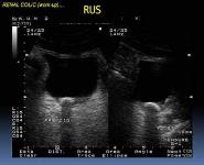 Emergency in Urology PowerPoint Presentation