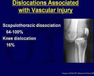 Evaluation and Treatment of Vascular Injury PowerPoint Presentation