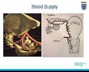 Uterus Broad Ligament Ovary PowerPoint Presentation