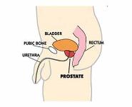 Prostate Health PowerPoint Presentation