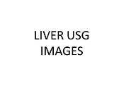 Liver Usg Images