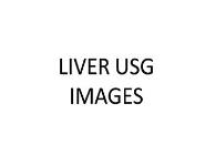 Liver Usg Images PowerPoint Presentation