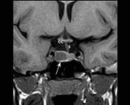 Adult Male Hypogonadism PowerPoint Presentation