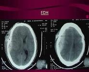 Quick Neurological Examination PowerPoint Presentation