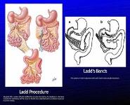 The Radiology of Malrotation PowerPoint Presentation