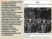 Radiological imaging of degenerative and inflammatory disease of the spine