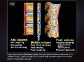 Thoracic Spine Trauma